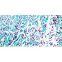 Diagnostic Biosystems