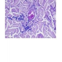 Diagnostic Biosystems