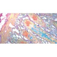 Diagnostic Biosystems