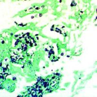 Diagnostic Biosystems
