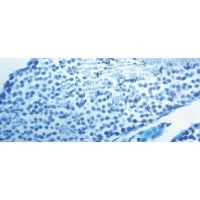 Diagnostic Biosystems