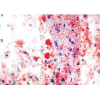 Diagnostic Biosystems